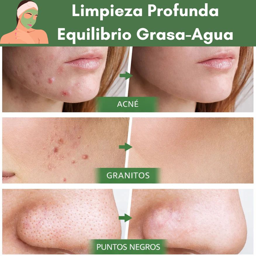 Green Mask - Para los que odian los puntos negros en la cara.