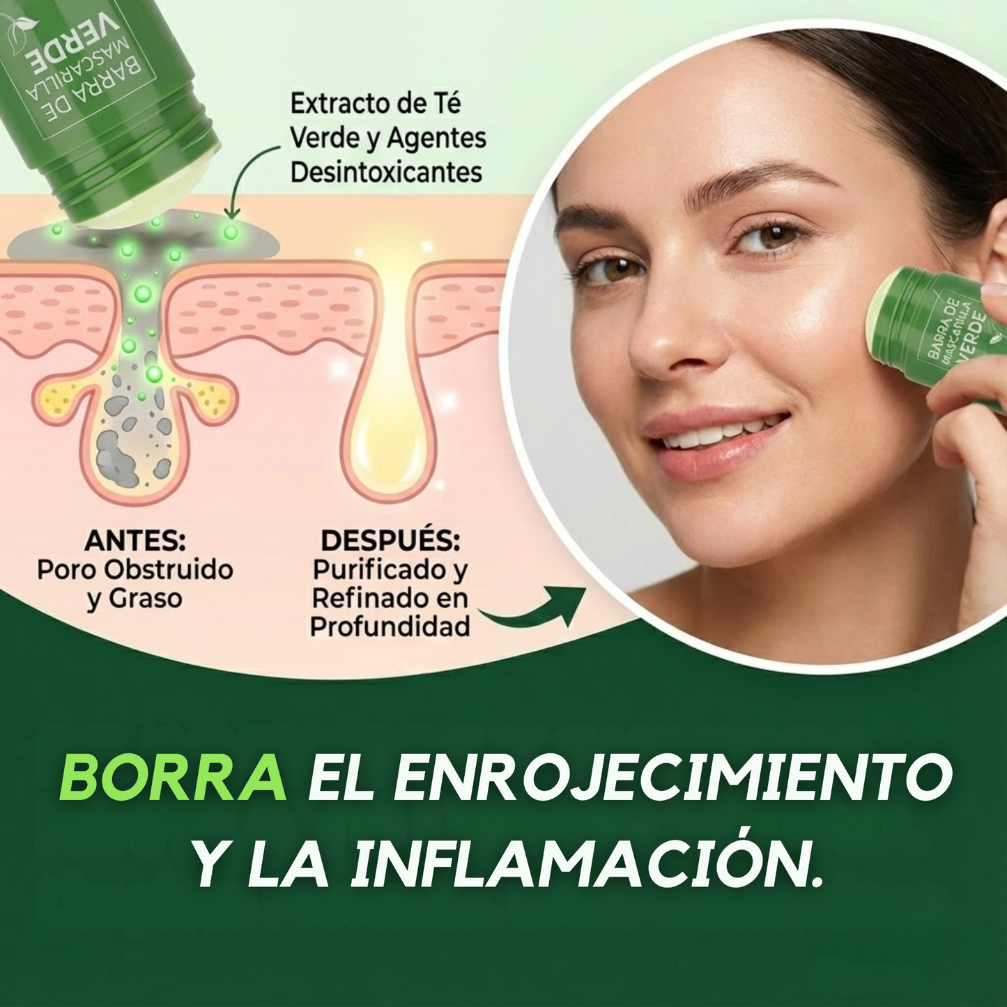 Green Mask - Para los que odian los puntos negros en la cara.
